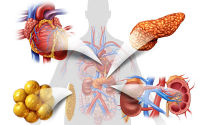 Lifestyle Disorders